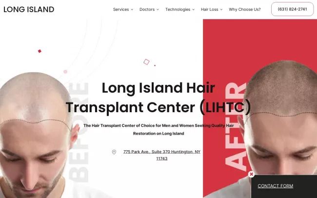 Long Island Hair Transplant 