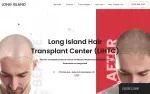 Long Island Hair Transplant 